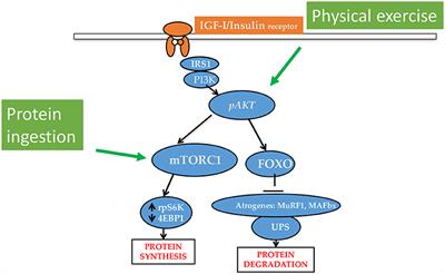 How to Overcome Anabolic Resistance in Dialysis-Treated Patients?